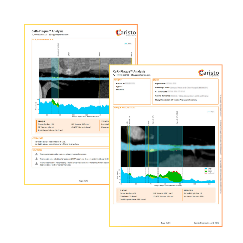 Plaque analysis report - Caristo Diagnostics